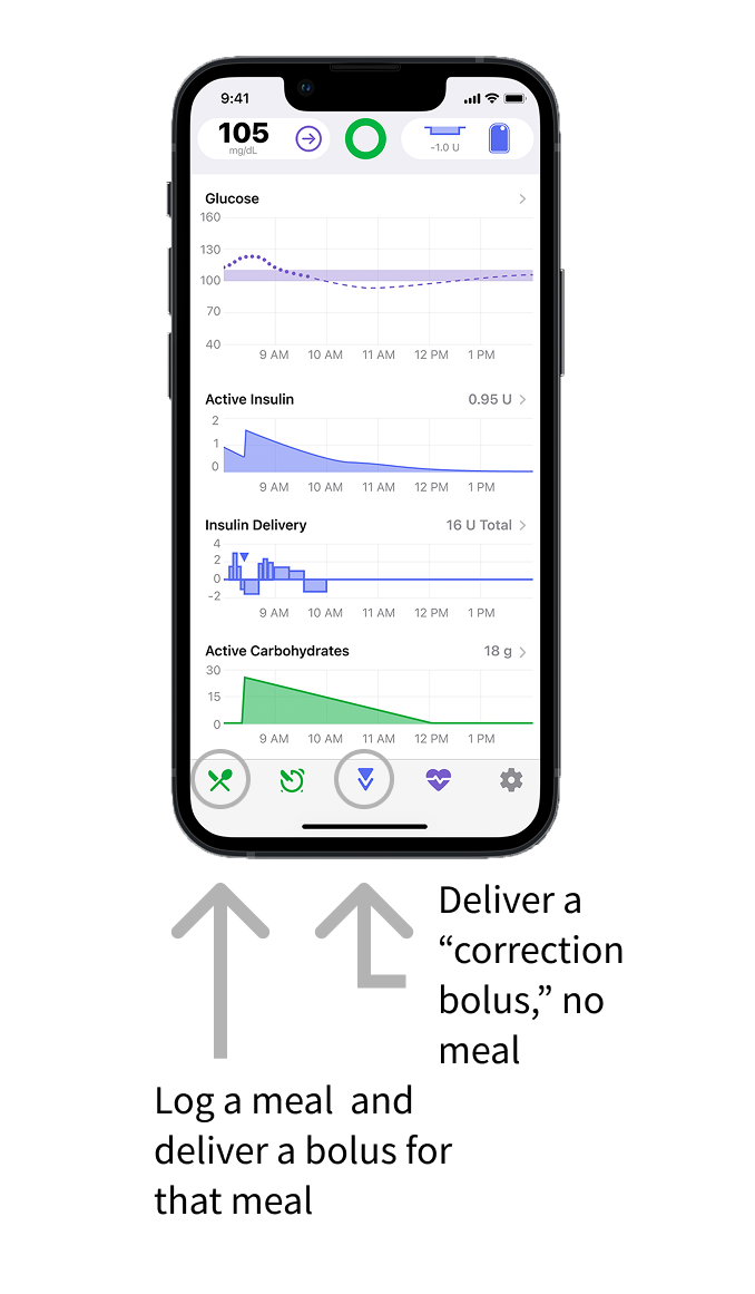 Image of the tidepool loop app with two grey arrows pointing to a circled icon of a green fork and knife with the text "log a meal and deliver a bolus for that meal," and a circled icon of two downwards violet triangles with the text "deliver a correction bolus, no meal"